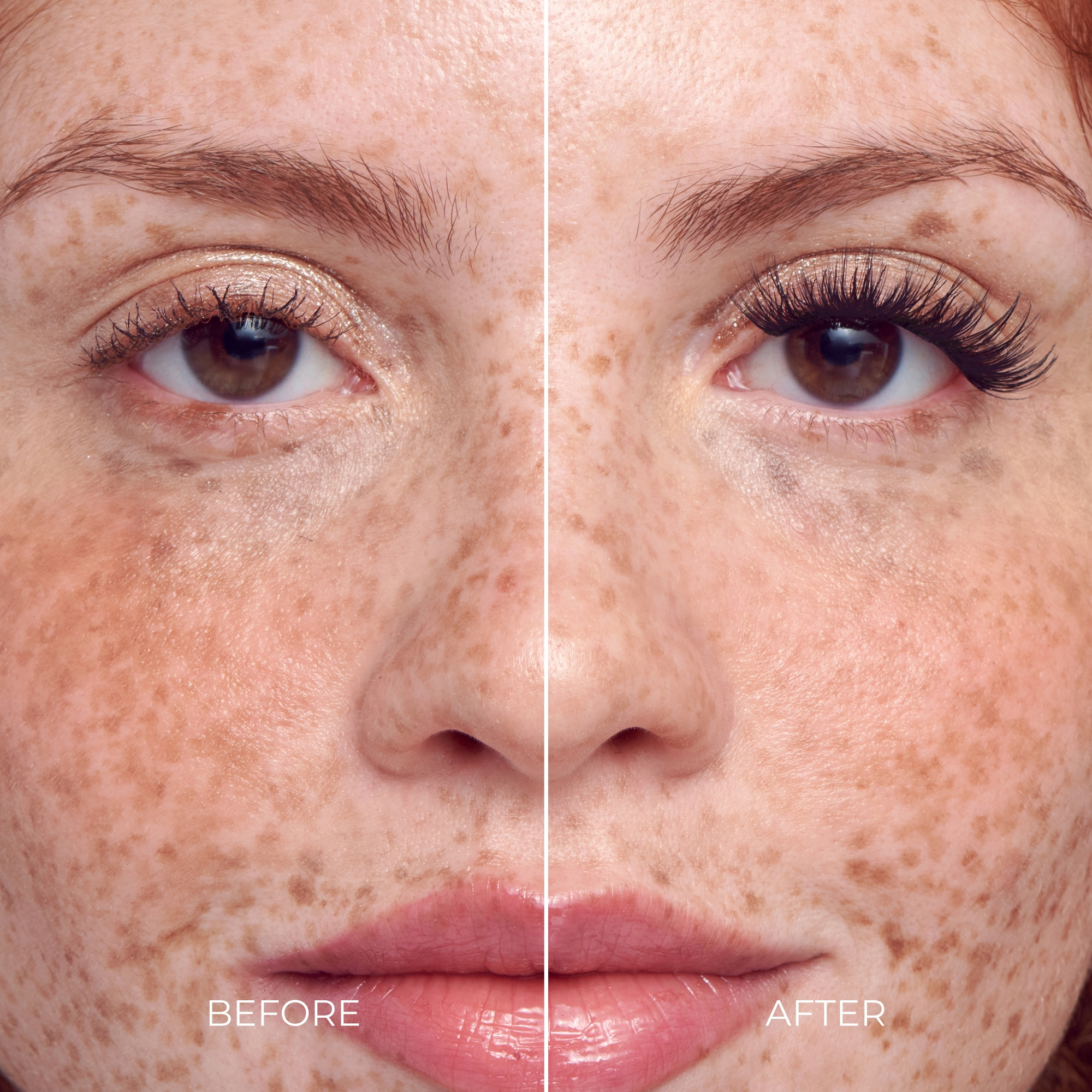Before and after comparison of a woman&