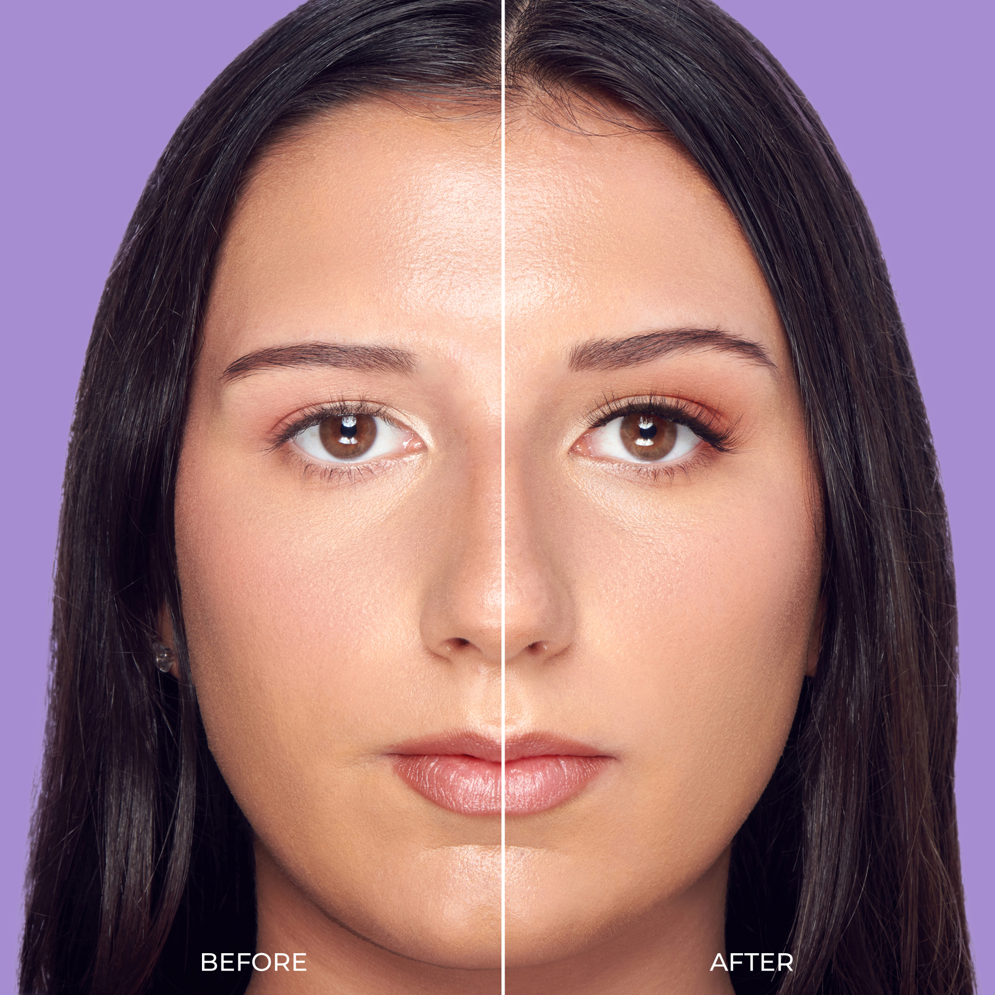 Before and after beauty treatment comparison showing facial enhancement results.