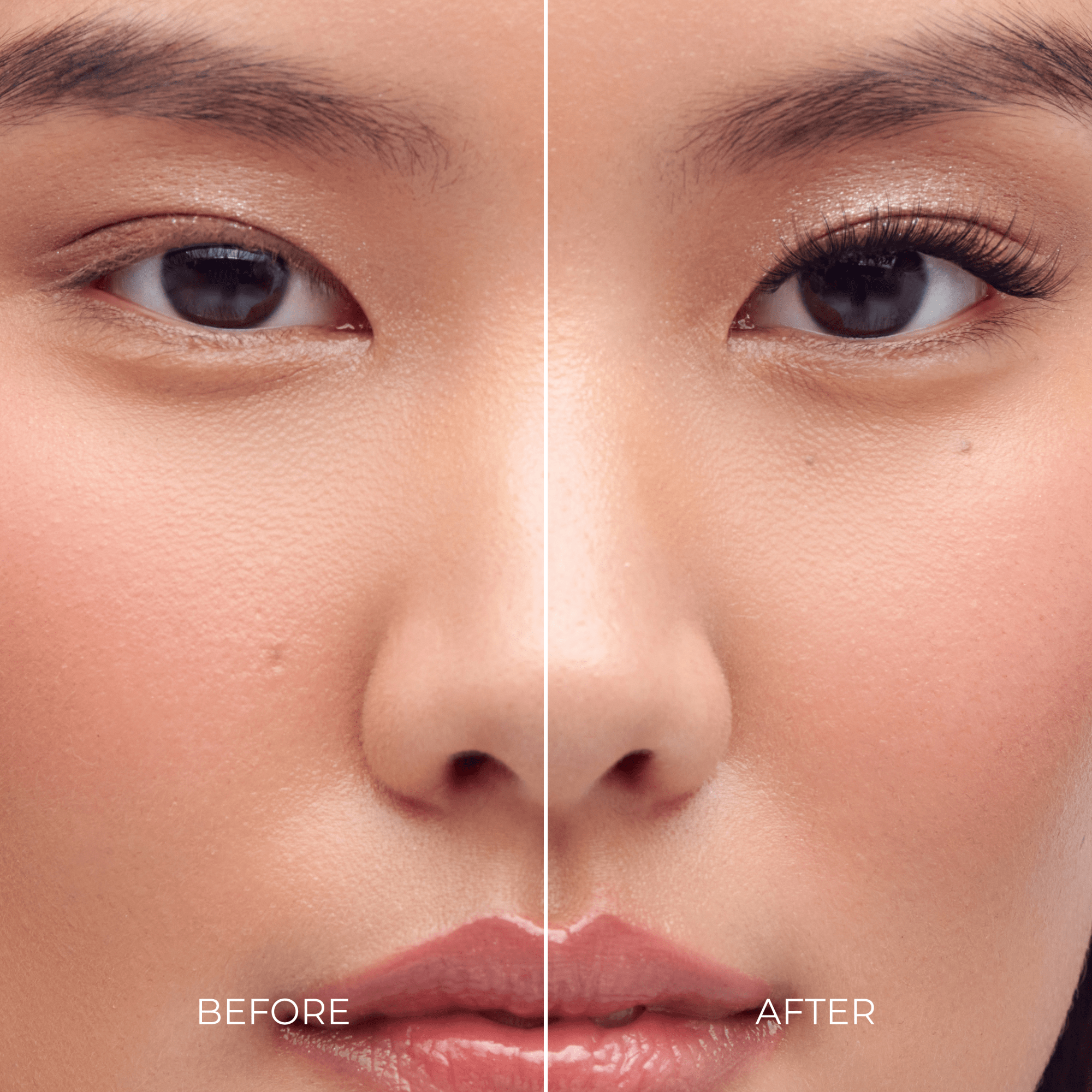 Before and after comparison of a woman&