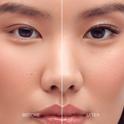 Before and after comparison of a woman&