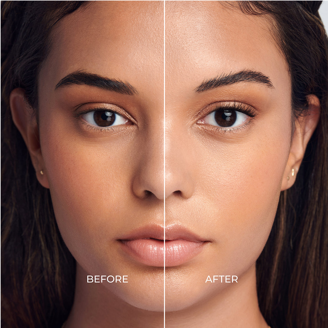 Before and after comparison of skin texture and appearance treatment results.